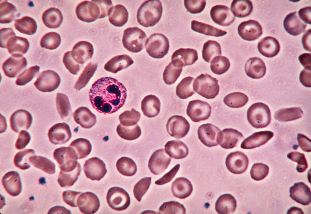 Cellarity_SCD_Microscopy 1